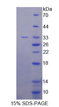 Snail同源物1(SNAI1)重組蛋白,Recombinant Snail Homolog 1 (SNAI1)