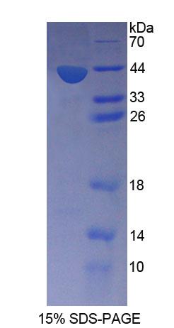 Snurportin 1蛋白(SNUPN1)重组蛋白,Recombinant Snurportin 1 (SNUPN1)