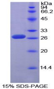 Sp100核抗原(Sp100)重组蛋白,Recombinant Sp100 Nuclear Antigen (Sp100)