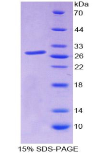 Sp140核体蛋白(SP140)重组蛋白,Recombinant Sp140 Nuclear Body Protein (SP140)