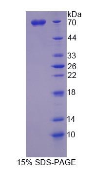 SPARC样蛋白1(SPARCL1)重组蛋白,Recombinant SPARC Like Protein 1 (SPARCL1)