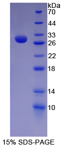 Split多毛增強(qiáng)子1(HES1)重組蛋白,Recombinant Hairy And Enhancer Of Split 1 (HES1)