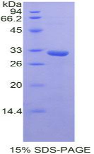 STAM結(jié)合蛋白(STAMBP)重組蛋白,Recombinant STAM Binding Protein (STAMBP)