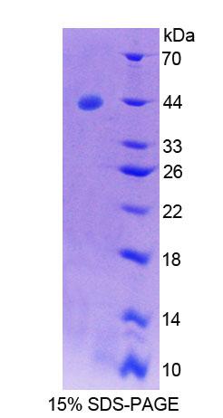 Syncollin蛋白(SYCN)重組蛋白,Recombinant Syncollin (SYCN)