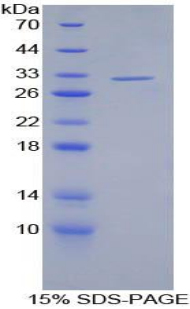 S抗原(SAG)重组蛋白,Recombinant S Antigen (SAG)