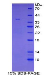 TATA盒结合蛋白(TBP)重组蛋白,Recombinant TATA Binding Protein (TBP)