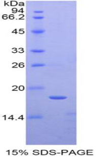 TATA框结合蛋白关联因子13(TAF13)重组蛋白,Recombinant TATA Box Binding Protein Associated Factor 13 (TAF13)