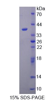 TATA框结合蛋白关联因子2(TAF2)重组蛋白,Recombinant TATA Box Binding Protein Associated Factor 2 (TAF2)