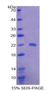 TBP结合转录向下调节因子1(DR1)重组蛋白,Recombinant Down Regulator Of Transcription 1, TBP Binding (DR1)
