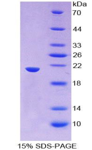 Thimet脫寡肽酶1(THOP1)重組蛋白,Recombinant Thimet Oligopeptidase 1 (THOP1)