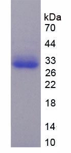 TNFRSF1A關(guān)聯(lián)Via死亡域蛋白(TRADD)重組蛋白,Recombinant TNFRSF1A Associated Via Death Domain Protein (TRADD)