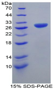 TNF受体关联因子1(TRAF1)重组蛋白,Recombinant TNF Receptor Associated Factor 1 (TRAF1)