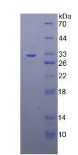 TNF受体关联因子4(TRAF4)重组蛋白,Recombinant TNF Receptor Associated Factor 4 (TRAF4)