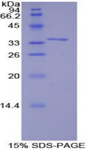 TNF受体关联因子6(TRAF6)重组蛋白,Recombinant TNF Receptor Associated Factor 6 (TRAF6)