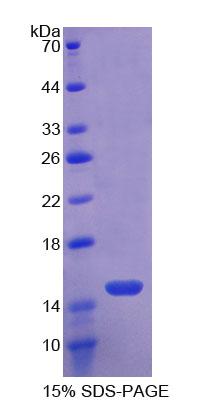 Toll样受体3(TLR3)重组蛋白,Recombinant Toll Like Receptor 3 (TLR3)