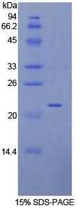 Toll样受体7(TLR7)重组蛋白,Recombinant Toll Like Receptor 7 (TLR7)