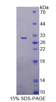 Toll样受体衔接分子1(TICAM1)重组蛋白,Recombinant Toll Like Receptor Adaptor Molecule 1 (TICAM1)