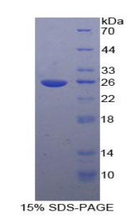 Toll样受体衔接分子2(TICAM2)重组蛋白,Recombinant Toll Like Receptor Adaptor Molecule 2 (TICAM2)