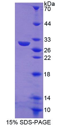 TRAF家族成员关联NFKB激活因子(TANK)重组蛋白,Recombinant TRAF Family Member Associated NFKB Activator (TANK)