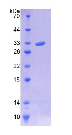 Twinkle蛋白(TWINL)重組蛋白,Recombinant Twinkle Protein, Mitochondrial (TWINL)