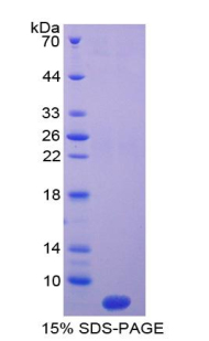 T-激肽原1(KNT1)重组蛋白,Recombinant T-Kininogen 1 (KNT1)