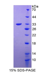 T-框蛋白4(TBX4)重組蛋白,Recombinant T-Box Protein 4 (TBX4)