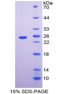 T-细胞激活连接蛋白(LAT)重组蛋白,Recombinant Linker For Activation Of T-Cell (LAT)