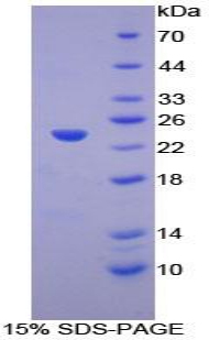 T-细胞激活连接蛋白家族成员2(LAT2)重组蛋白,Recombinant Linker For Activation Of T-Cells Family, Member 2 (LAT2)