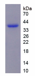 T-细胞免疫调节因子1(TCIRG1)重组蛋白,Recombinant T-Cell, Immune Regulator 1 (TCIRG1)