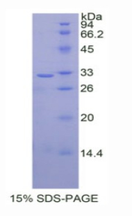 UDP葡糖醛酸基转移酶1家族多肽A1(UGT1A1)重组蛋白,Recombinant UDP Glucuronosyltransferase 1 Family, Polypeptide A1 (UGT1A1)