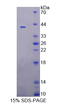 UDP-葡萄糖糖蛋白糖基转移酶1(UGGT1)重组蛋白,Recombinant UDP-Glucose Glycoprotein Glucosyltransferase 1 (UGGT1)