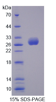 UL16结合蛋白2(ULBP2)重组蛋白,Recombinant UL16 Binding Brotein 2 (ULBP2)