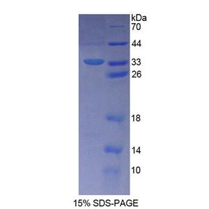 Schlafen家族成员5(SLFN5)重组蛋白