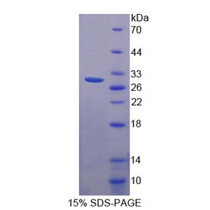 SCO细胞色素氧化酶缺陷同源物2(SCO2)重组蛋白
