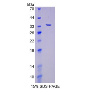 SHC-转化蛋白1(SHC1)重组蛋白