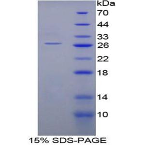 SHC-转化蛋白2(SHC2)重组蛋白