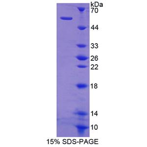 SHC-转化蛋白3(SHC3)重组蛋白,Recombinant SHC-Transforming Protein 3 (SHC3)