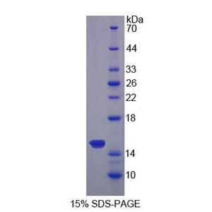 Sideroflexin 1蛋白(SFXN1)重组蛋白