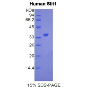 Slit同源物1(Slit1)重组蛋白,Recombinant Slit Homolog 1 (Slit1)