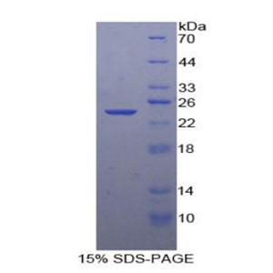 Smad同源物3(Smad3)重组蛋白