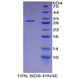 Smad同源物4(Smad4)重组蛋白