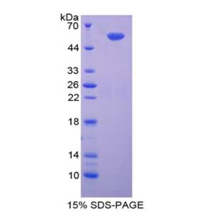 Smad同源物9(Smad9)重组蛋白,Recombinant SMAD family member 9 (SMAD9)