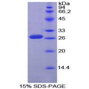 Sp100核抗原(Sp100)重组蛋白,Recombinant Sp100 Nuclear Antigen (Sp100)