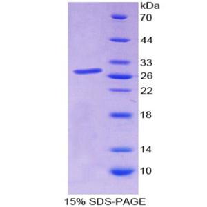 Sp140核体蛋白(SP140)重组蛋白