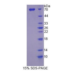 SPARC样蛋白1(SPARCL1)重组蛋白,Recombinant SPARC Like Protein 1 (SPARCL1)