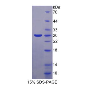 S-期激酶关联蛋白1(SKP1)重组蛋白,Recombinant S-Phase Kinase Associated Protein 1 (SKP1)