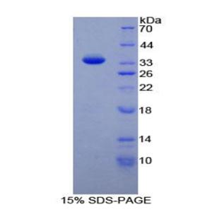 TATA框结合蛋白关联因子1(TAF1)重组蛋白,Recombinant TATA Box Binding Protein Associated Factor 1 (TAF1)