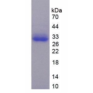 TNFRSF1A关联Via死亡域蛋白(TRADD)重组蛋白