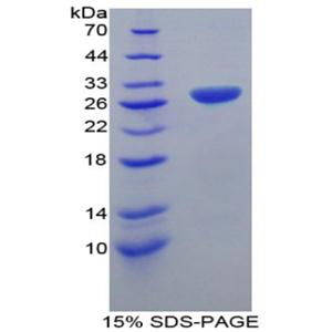 TNF受体关联因子1(TRAF1)重组蛋白,Recombinant TNF Receptor Associated Factor 1 (TRAF1)