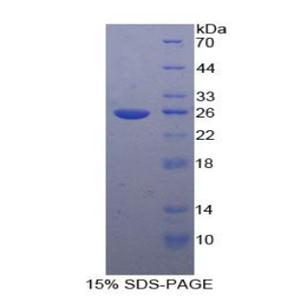 Toll样受体衔接分子2(TICAM2)重组蛋白,Recombinant Toll Like Receptor Adaptor Molecule 2 (TICAM2)